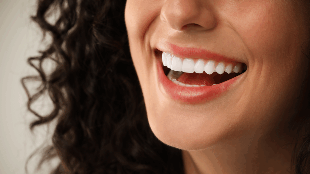 3 Things you should know before getting Veneers